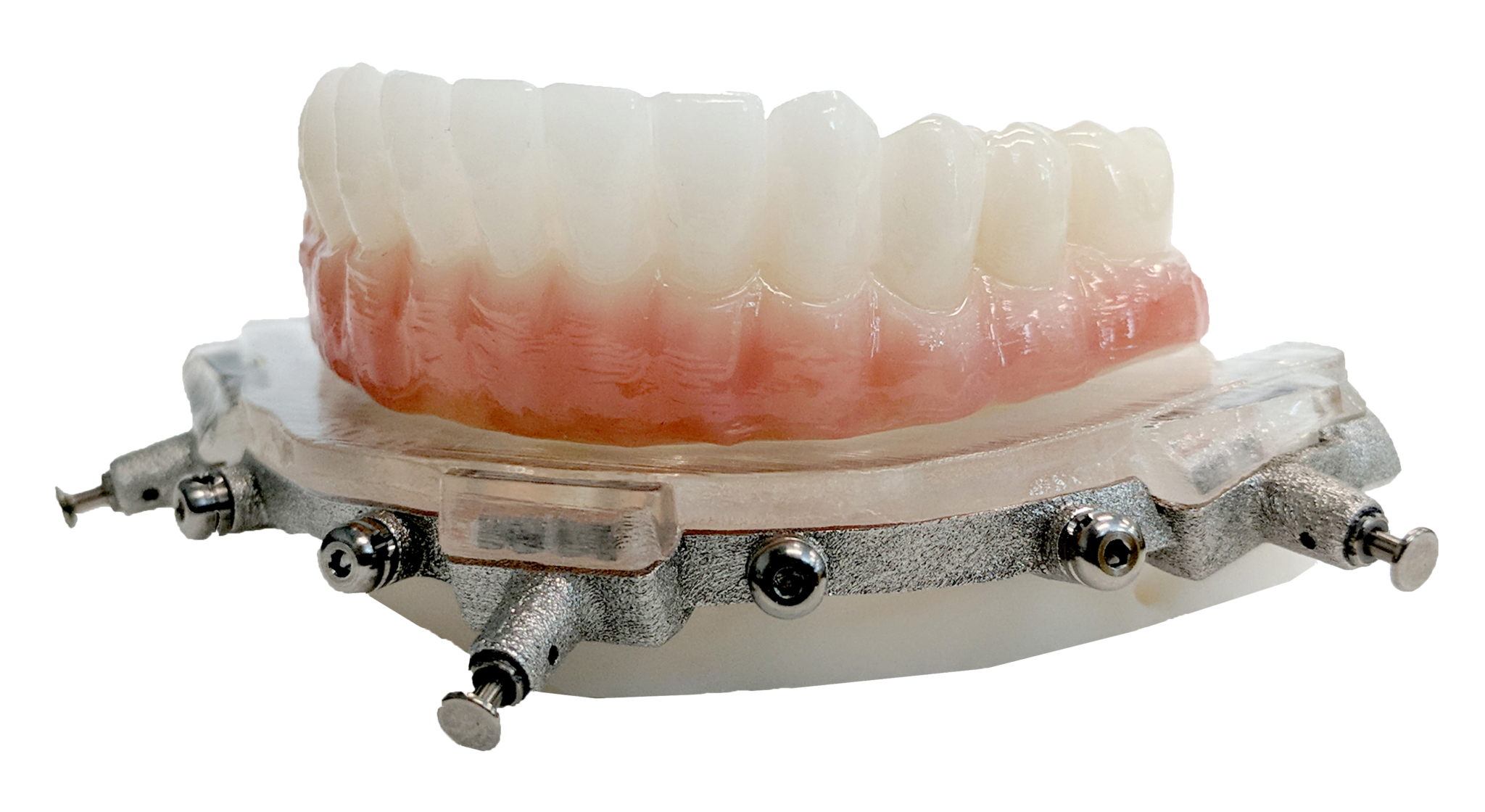 Dental Implant Prosthetics Crane Dental