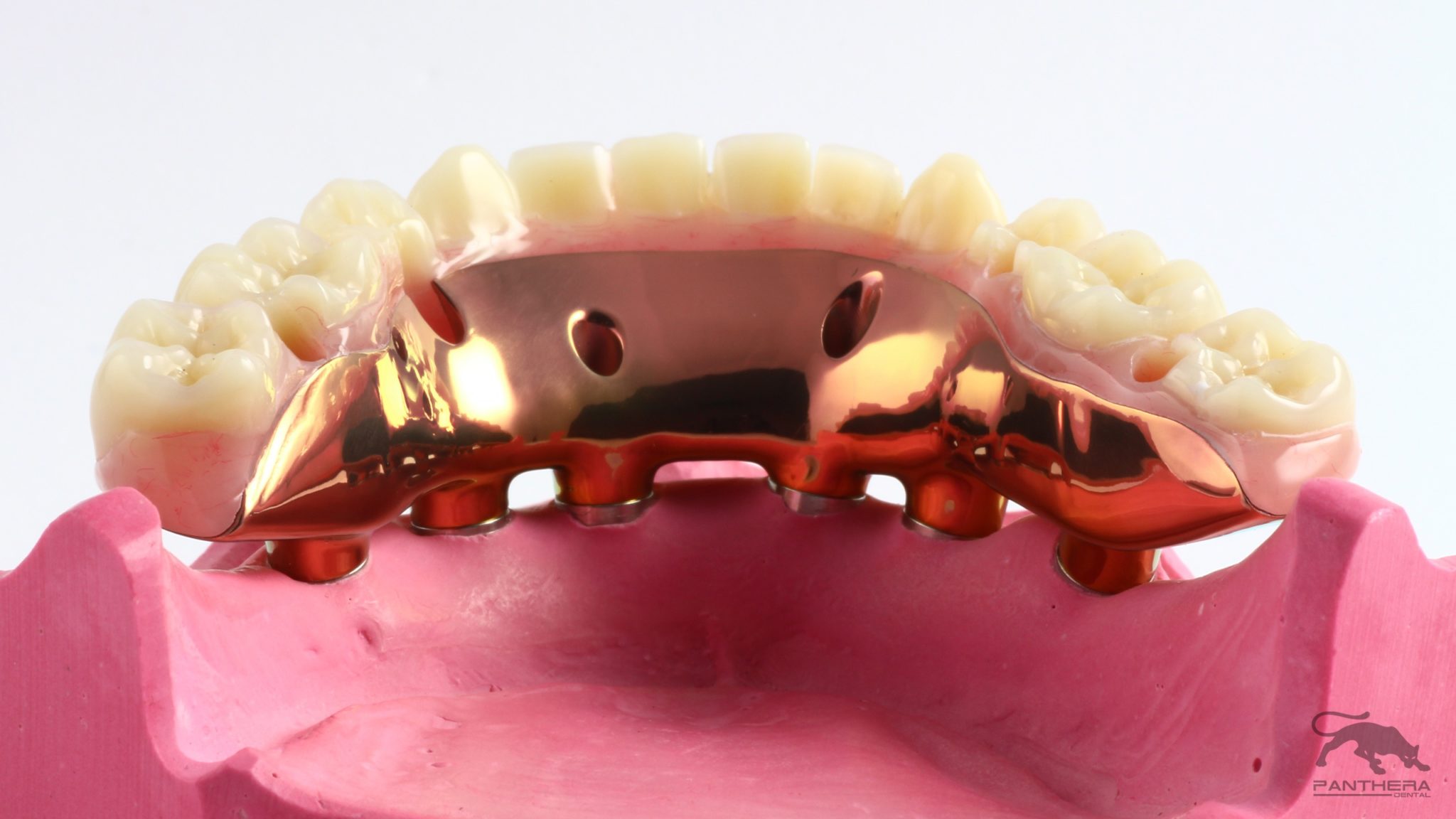 Dental Implant Prosthetics Crane Dental